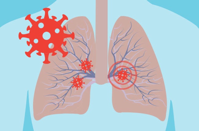 lungs illustration with attacking red molecules
